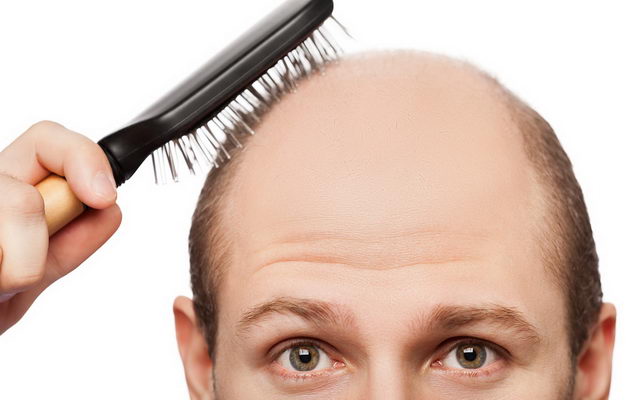 Средства против выпадения волос у мужчин