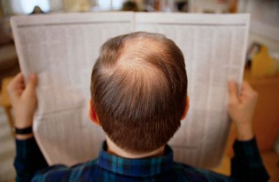 Выпадение волос очаговая алопеция причина
