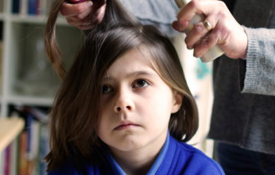 Очаговое выпадение волос у ребенка причины